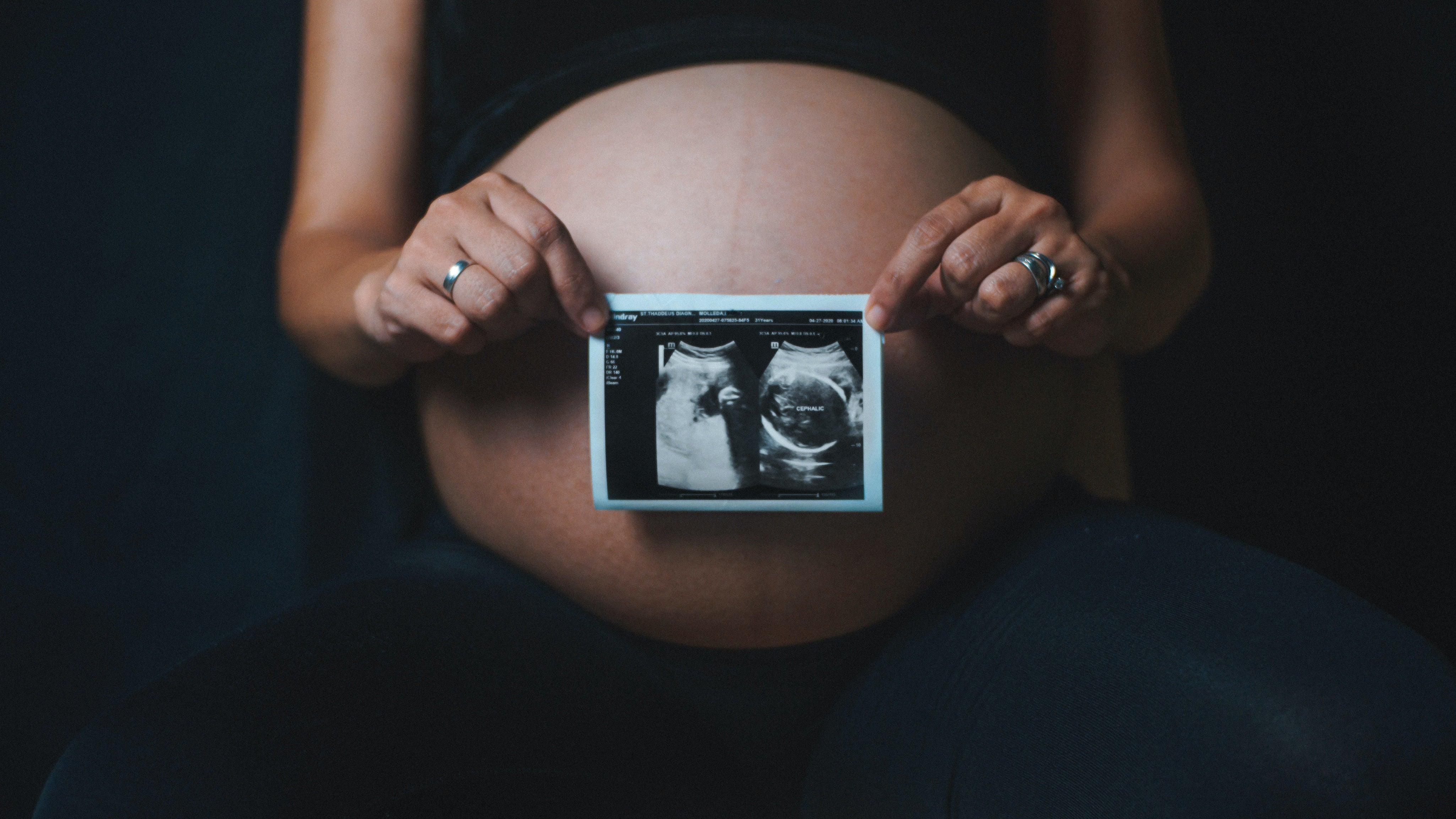 Obstetrician vs Gynaecologist: What's The Difference?